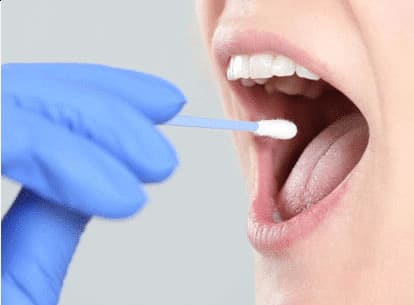 Prélèvement buccal avec un écouvillon pour réaliser un test ADN de paternité